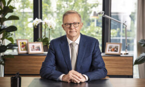 Anthony'is Albanese'as. Wikimedia nuotr.