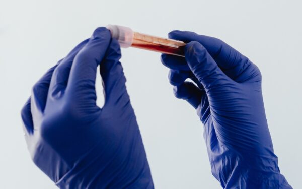 Mokslininkai perspėja: kosmose astronautėms gali grėsti pavojingi kraujo krešuliai