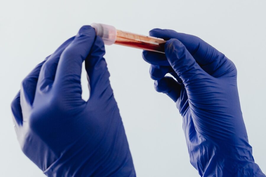 Mokslininkai perspėja: kosmose astronautėms gali grėsti pavojingi kraujo krešuliai