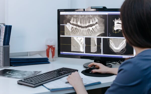 Kaip sumažinti išlaidų šoką einant pas odontologą: ką reikia žinoti apie kainas, kompensacijas ir sutartis