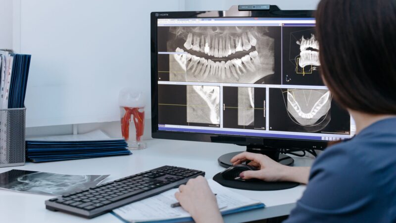Kaip sumažinti išlaidų šoką einant pas odontologą: ką reikia žinoti apie kainas, kompensacijas ir sutartis